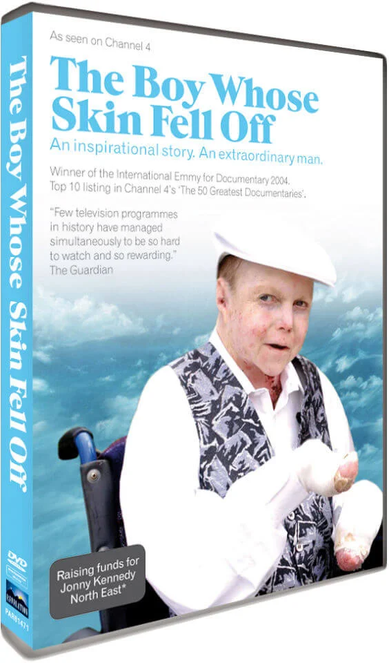 Boy Whose Skin Fell Off Bild 1