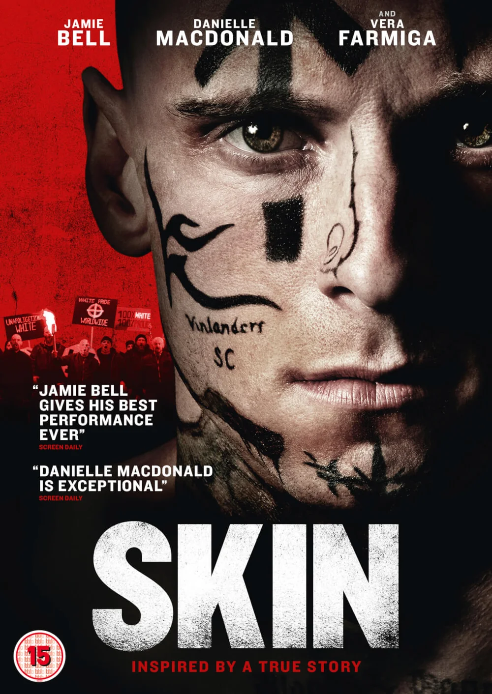 Skin Bild 1