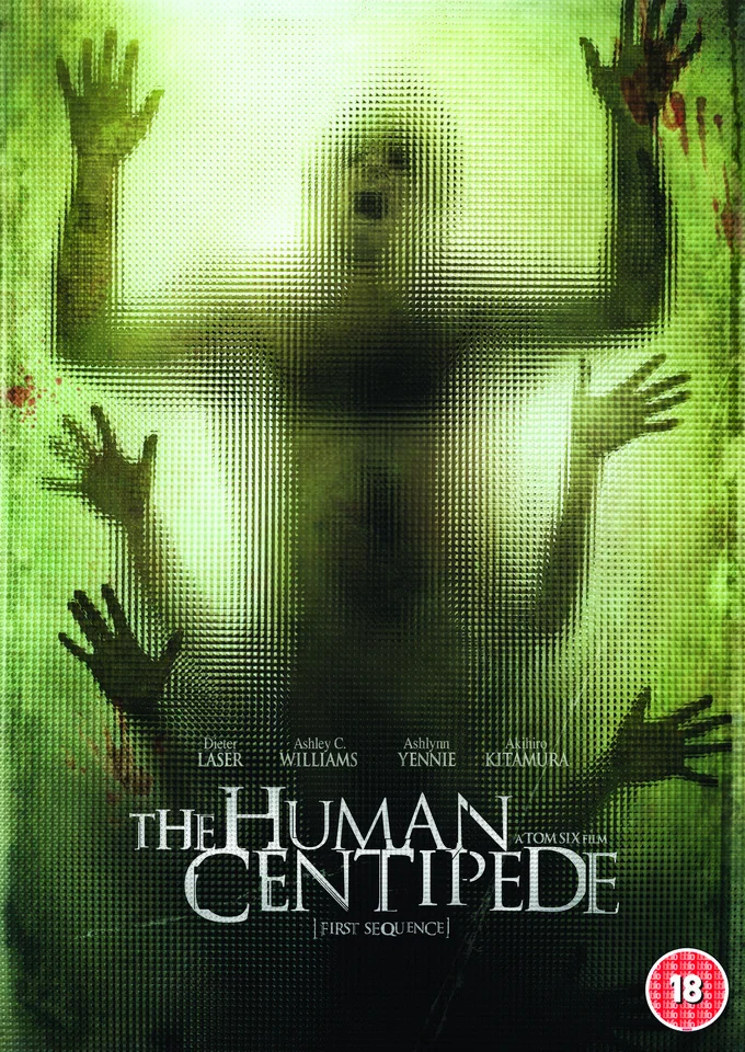 The Human Centipede Bild 1